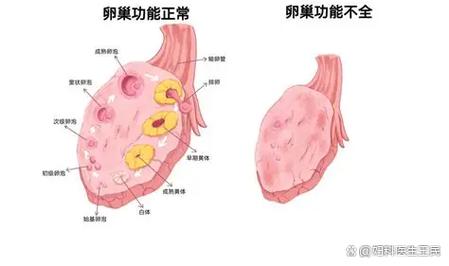 女性卵巢储备功能检测示意图
